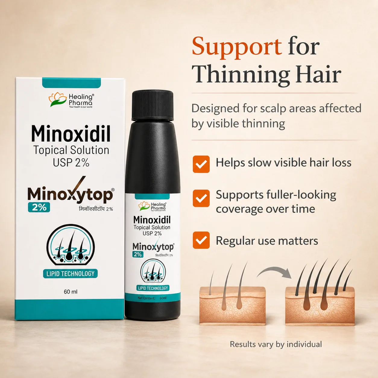 Minoxidil Topical Solution USP 2%, 60ml | Minoxytop for Hair Loss